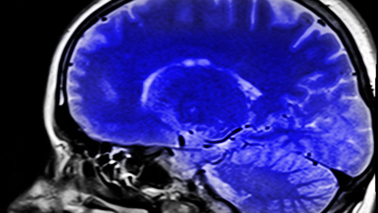 Новое исследование показало, что люди старше 80...