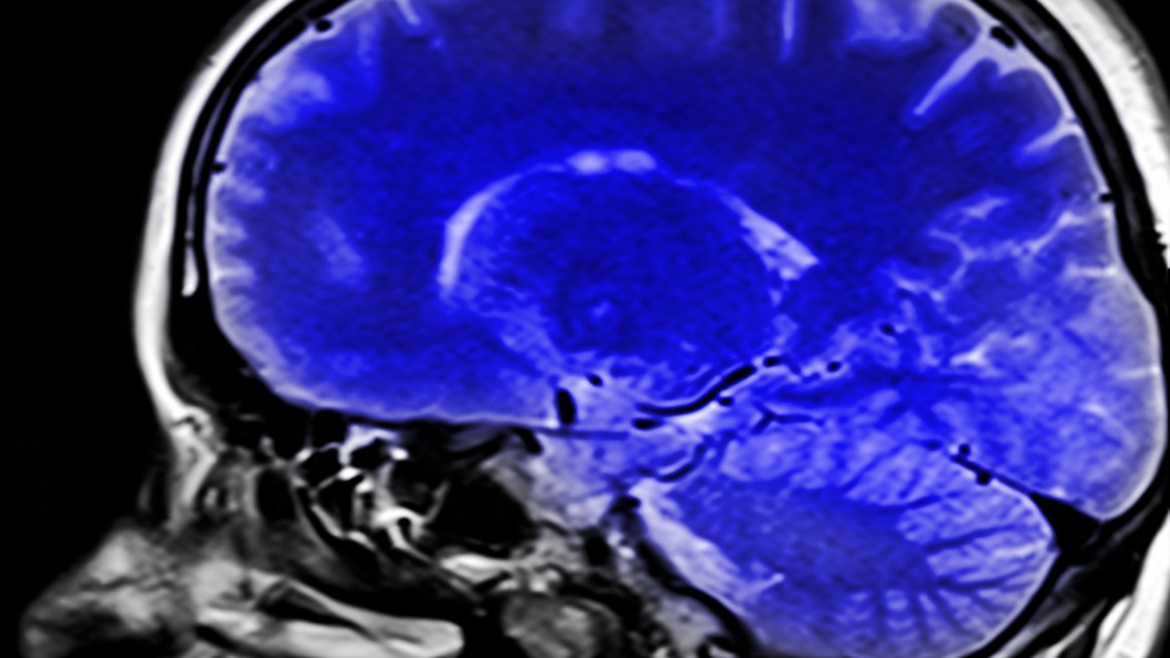 ИИ помог выяснить: многие смерти при COVID-19 вызваны не вирусом Исследователи из Северо-Западного университета ...