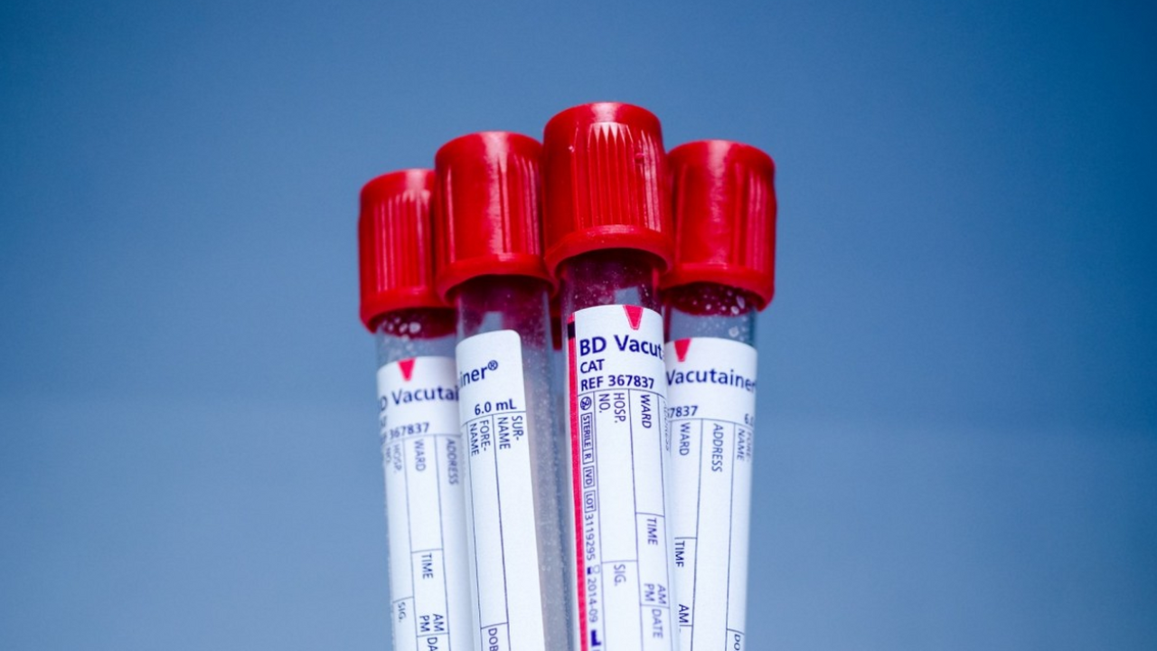 Исследование, опубликованное в журнале Lancet, ...
