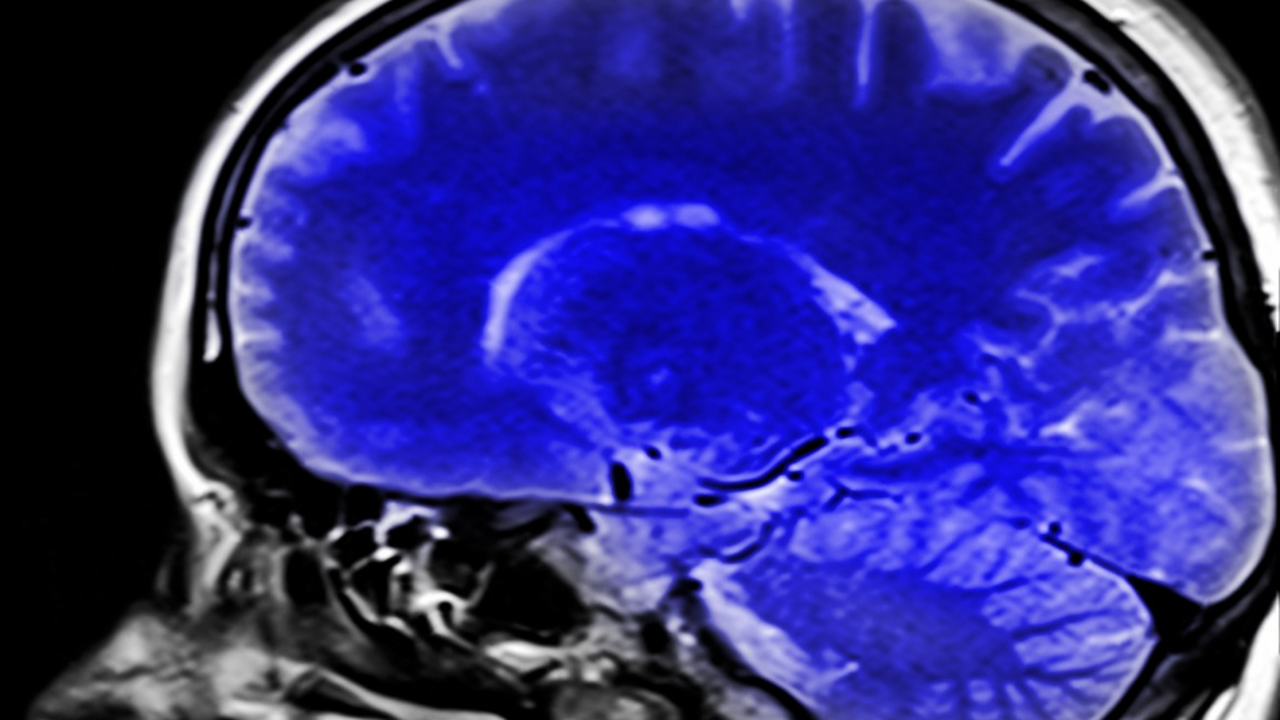 С возрастом наш мозг замедляет производство нов...