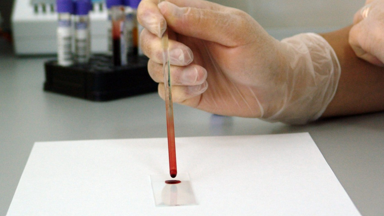 Ученые из Sinai Health разработали тест, позвол...