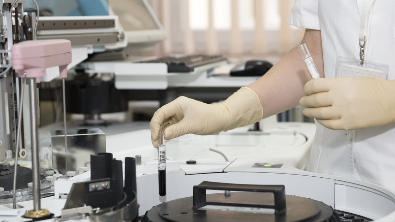 Остеопороз можно обнаружить на ранней стадии благодаря общему анализу крови Исследователи рекомендуют уделять внимание уров...