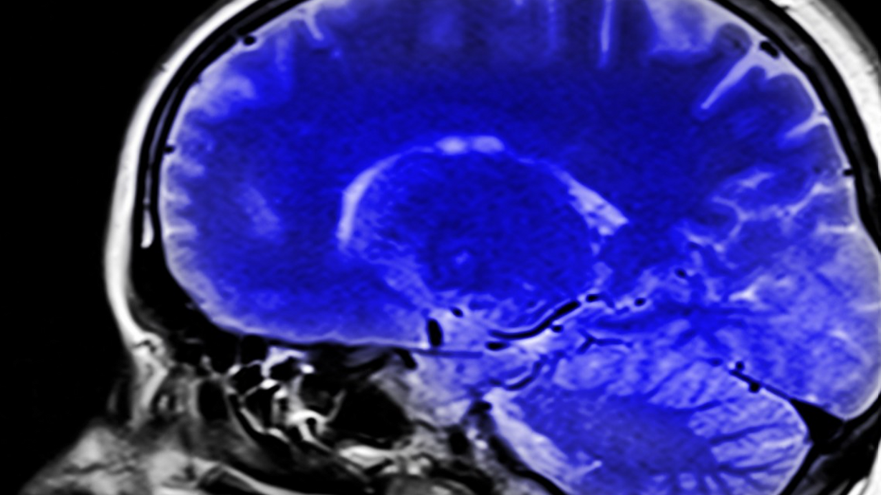 Ученые из Сколтеха, Института искусственного ин...