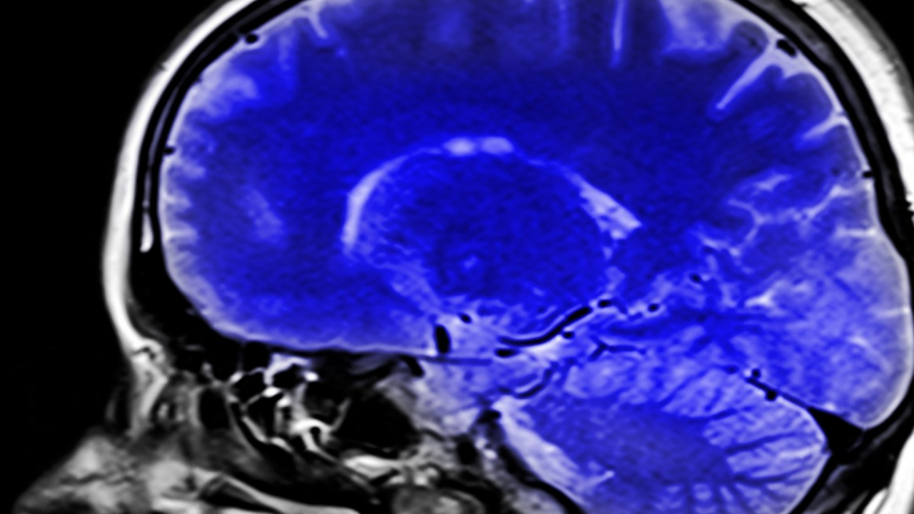 Исследователи из центра Baycrest совместно с уч...