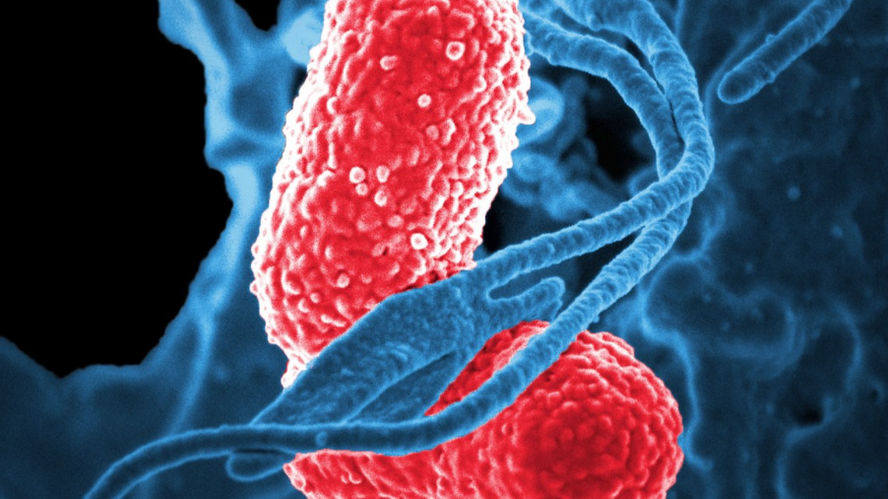 Ученые нашли способ замедлить рак кишечника через блокировку одного белка Блокирование одного белка внутри клеток может з...