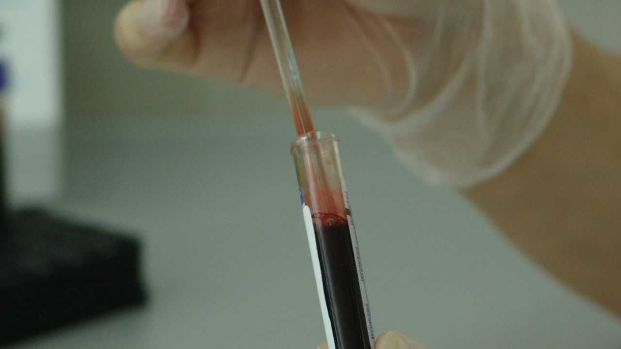 Коагулограмма — это не просто анализ на «густот...