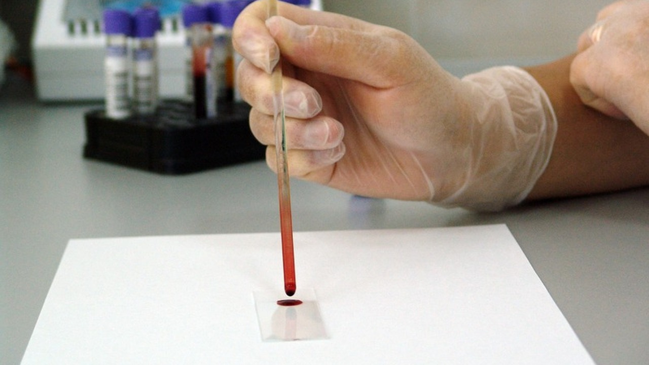 Донорам крови в Ульяновской области повысили компенсацию С 1 января 2026 года в Ульяновской области увел...