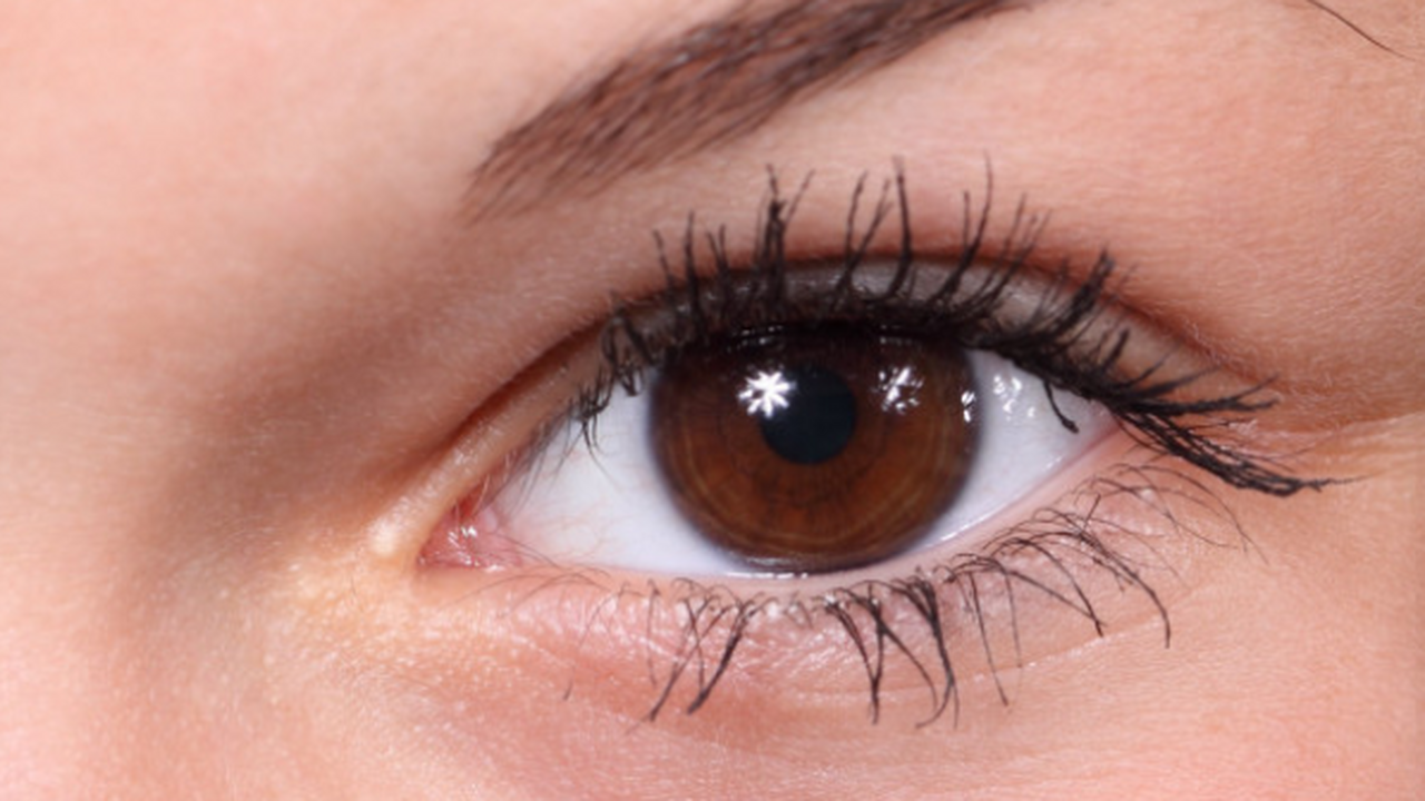 Наращивание ресниц может привести к воспалению,...