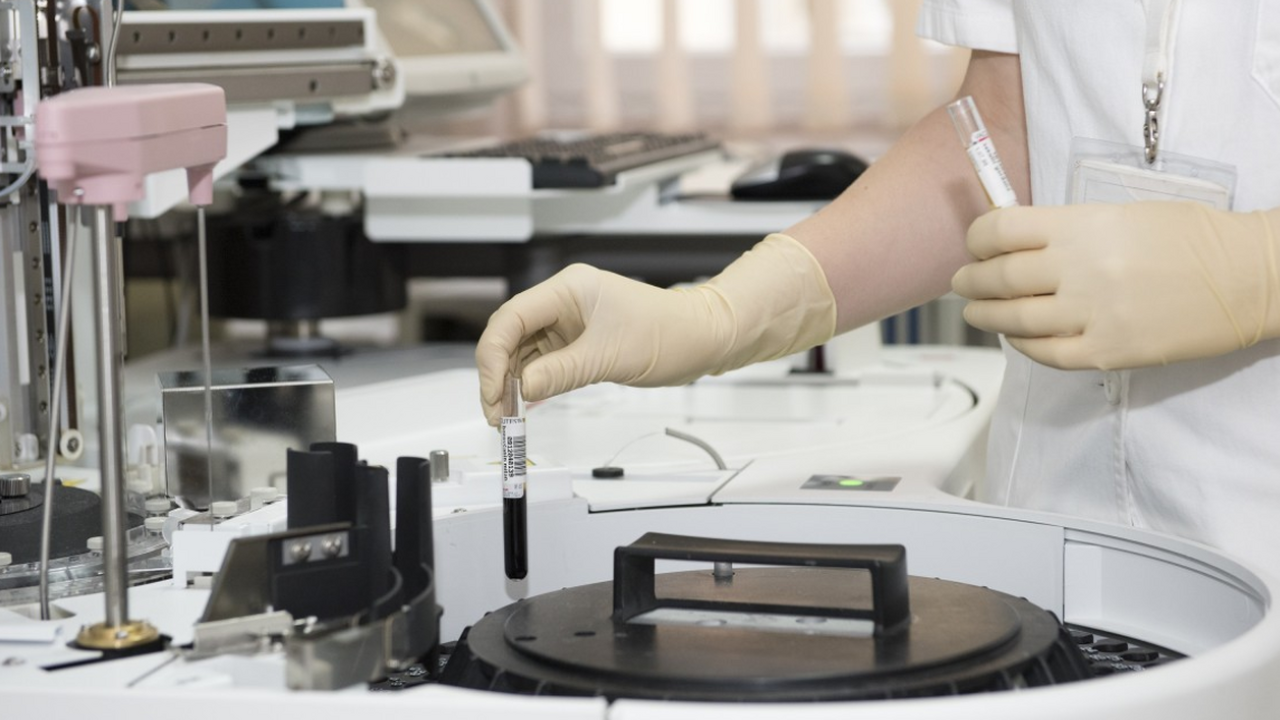 Австралия создала тест для ранней диагностики сердечной недостаточности Австралийские специалисты представили новую мет...