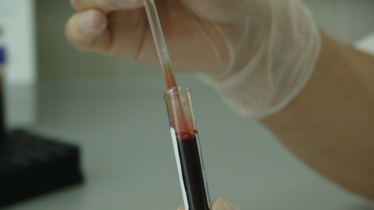 Ученые центра «Вектор» в Новосибирской области ...