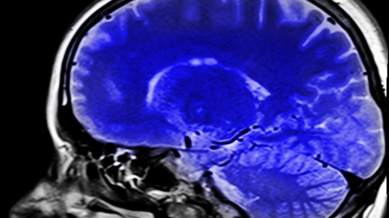 Исследование, опубликованное в журнале «Biomedi...