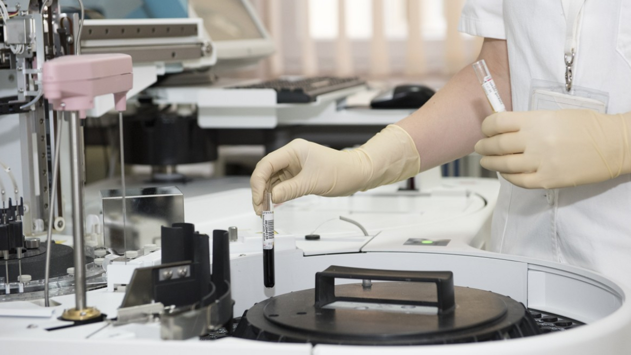 Учёные обнаружили тревожный сигнал рака в обычном анализе крови Анемия, впервые выявленная у взрослых, может бы...