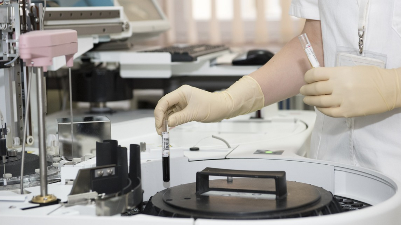 JMV: у людей переболевших COVID-19 нашли липкие «сети» из ДНК У людей, перенёсших COVID-19 и столкнувшихся с ...