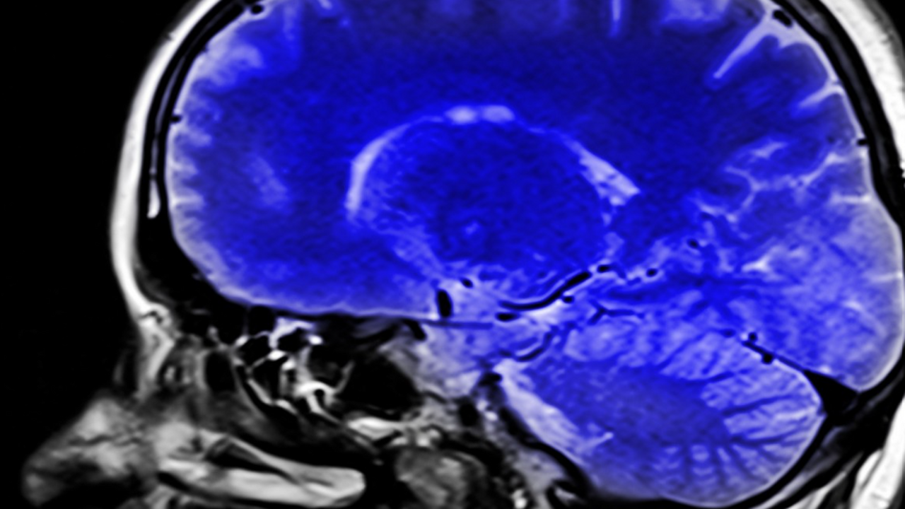 Учёные выяснили, что опасность для мозга опреде...