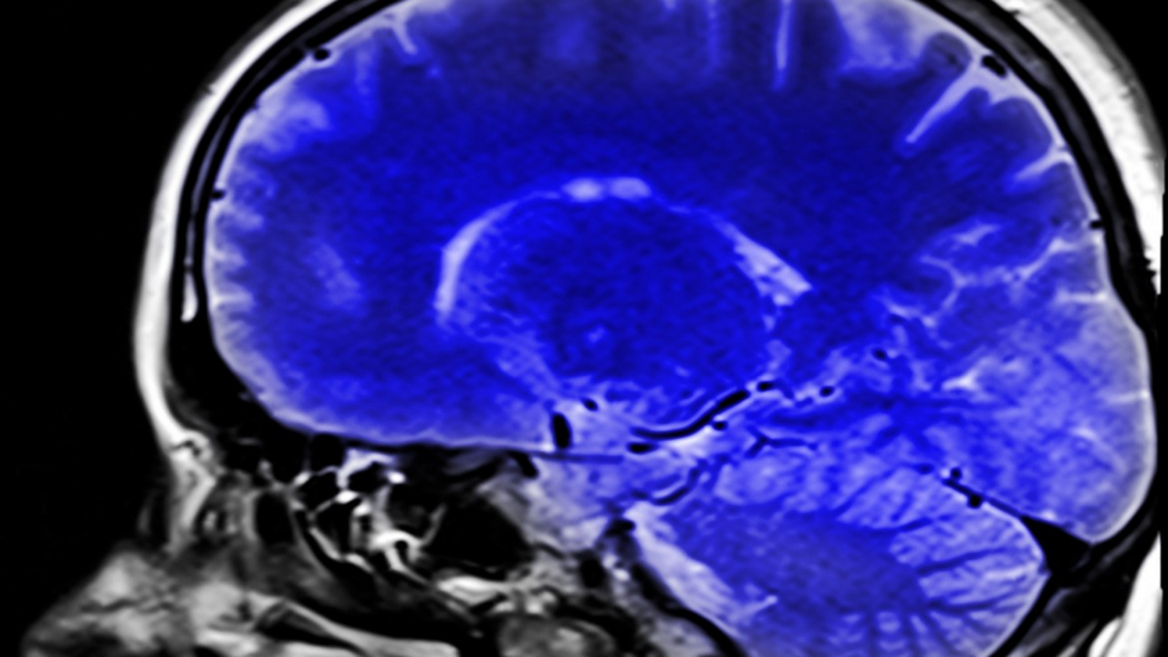Американские исследователи заявили о прорыве в ...