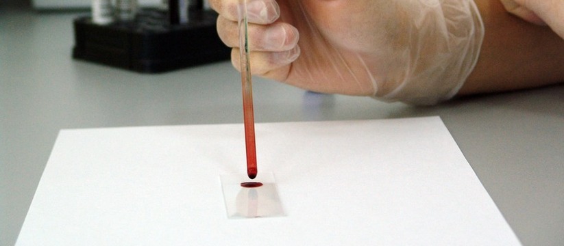 Ульяновским медикам срочно требуются доноры редкой группы крови В Ульяновской области объявлен срочный поиск до...